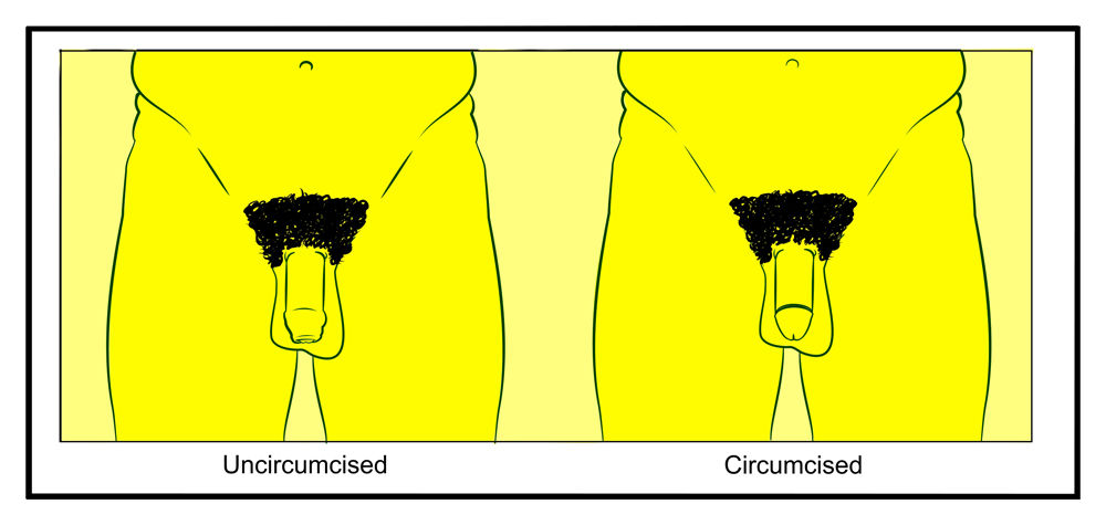 Front view cartoon images of an uncircumsised penis and a circumcised penis